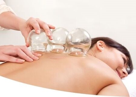 Cupping-Therapy-Therapy